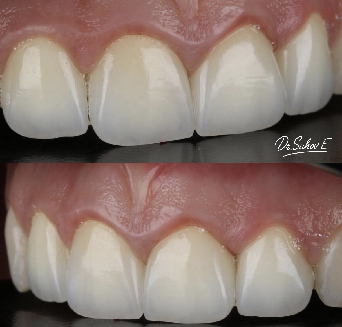 После лечения