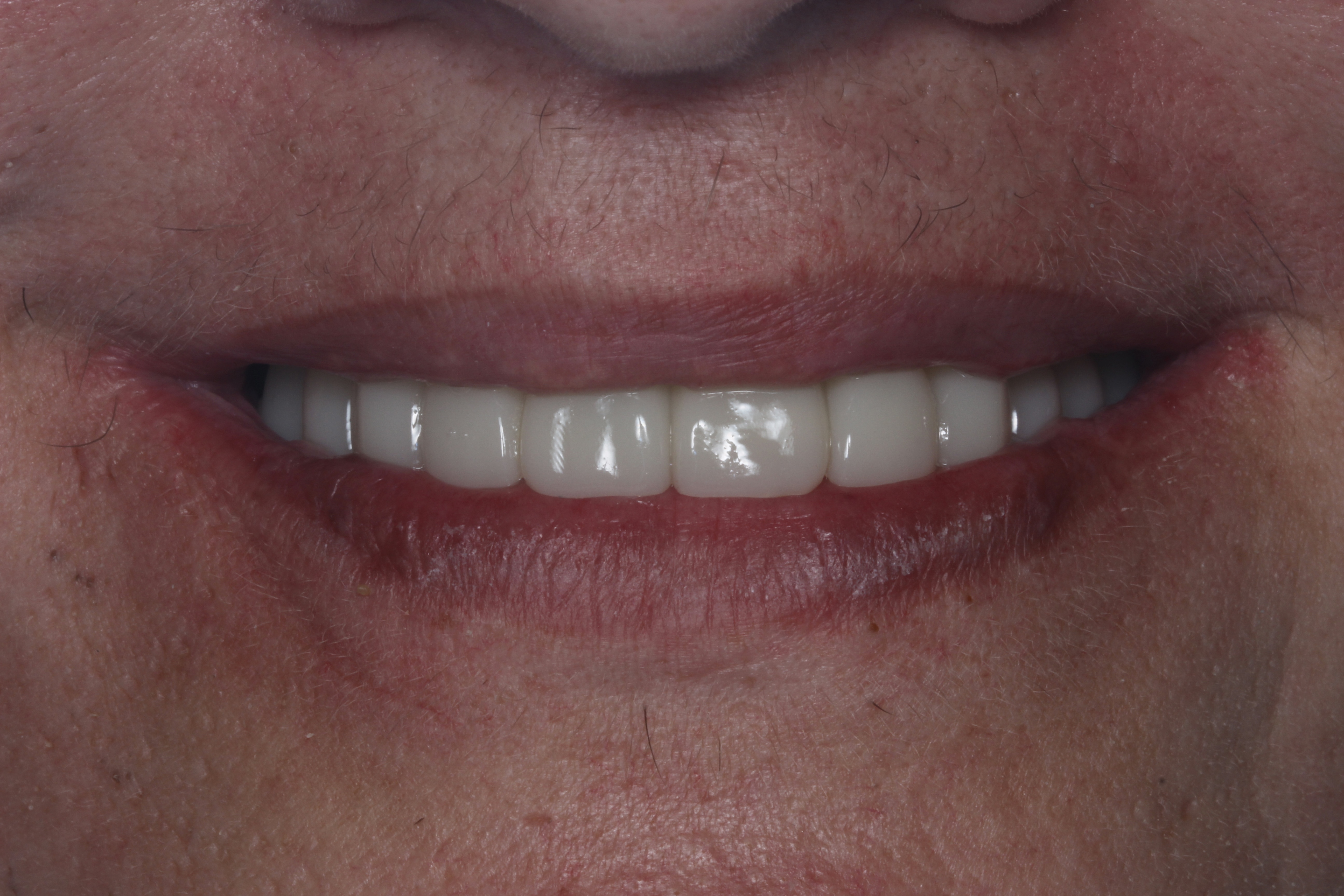 После лечения