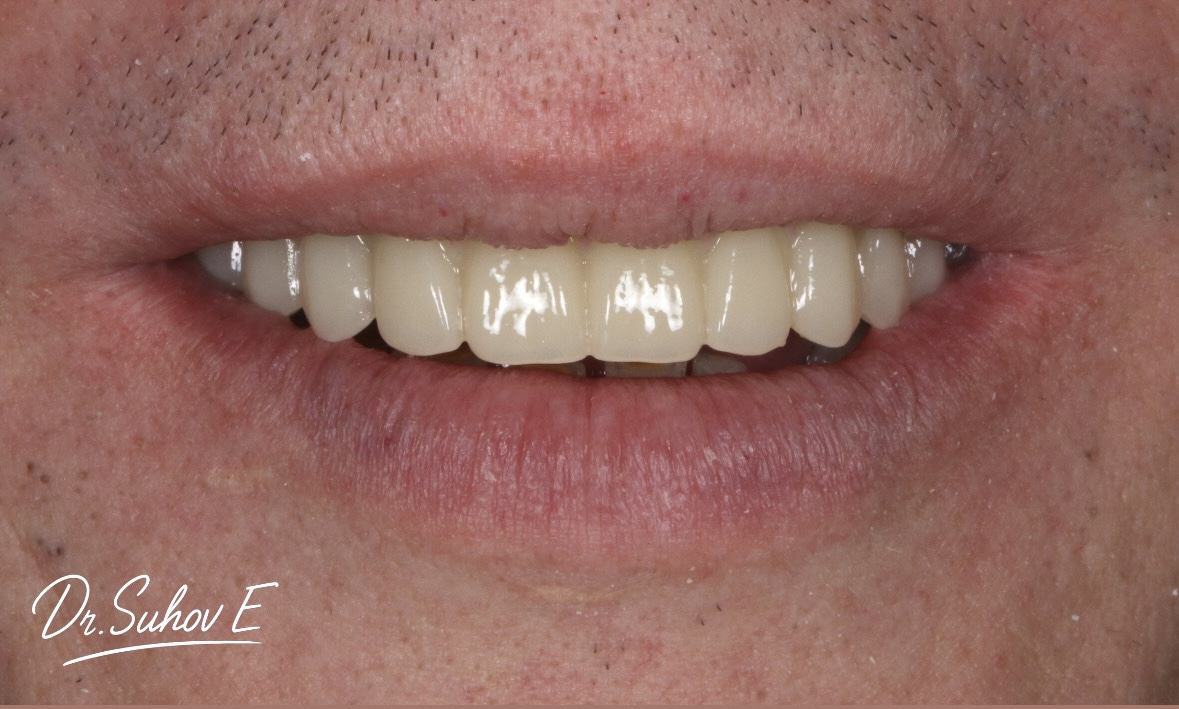 После лечения