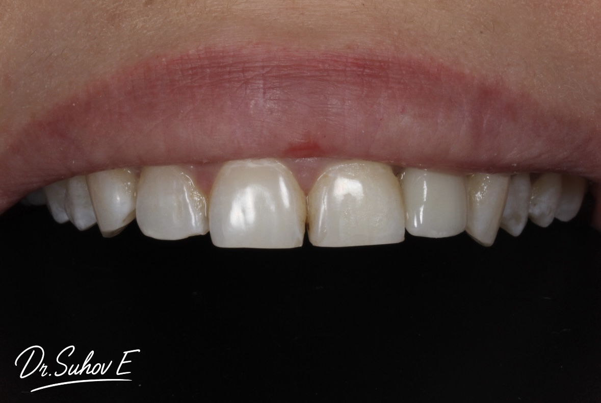 После лечения