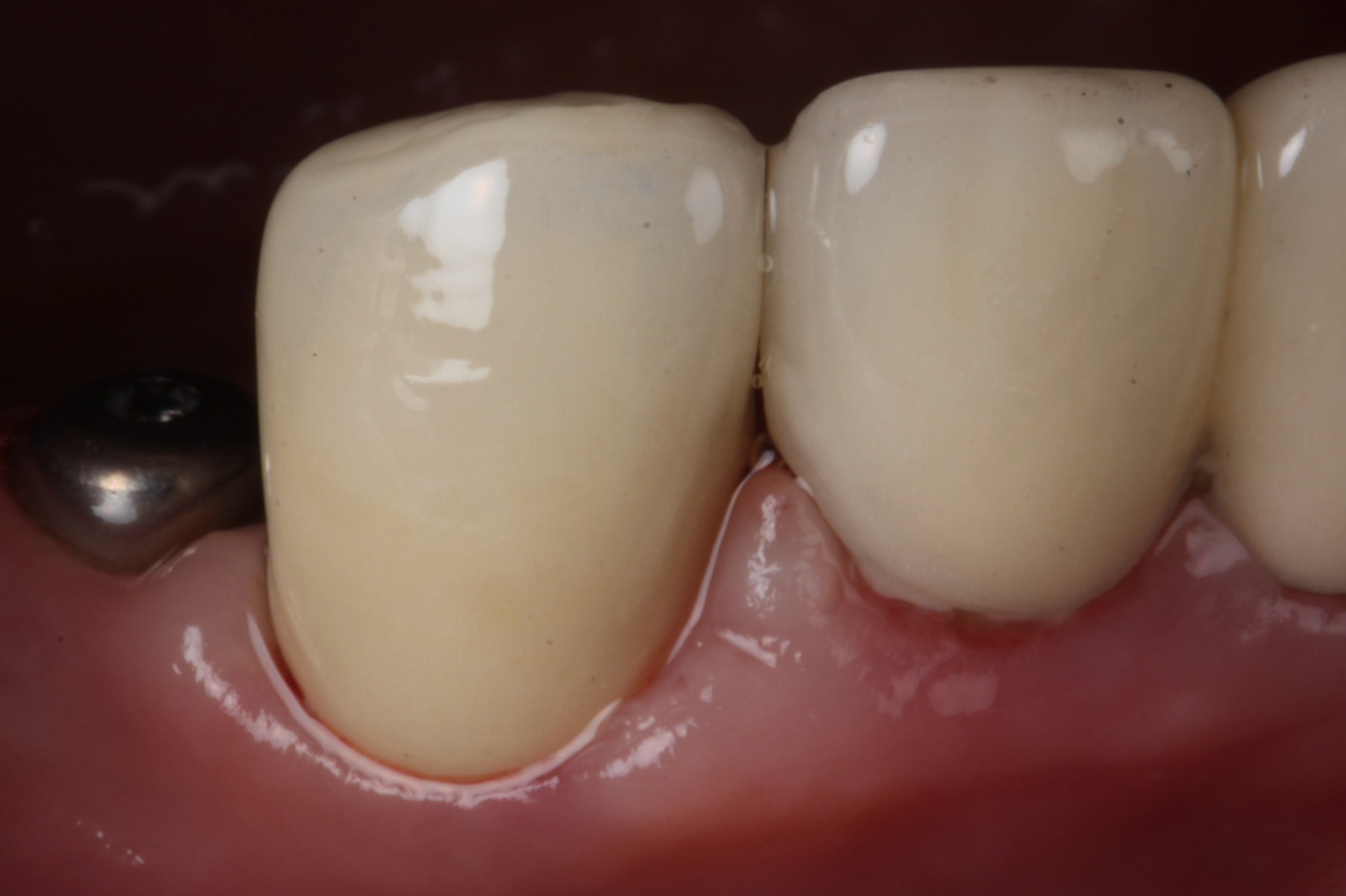 После лечения