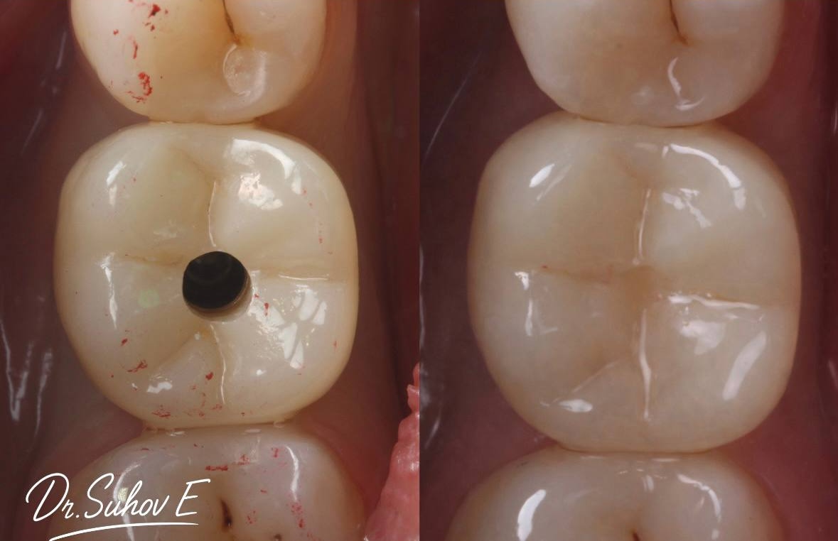 После лечения