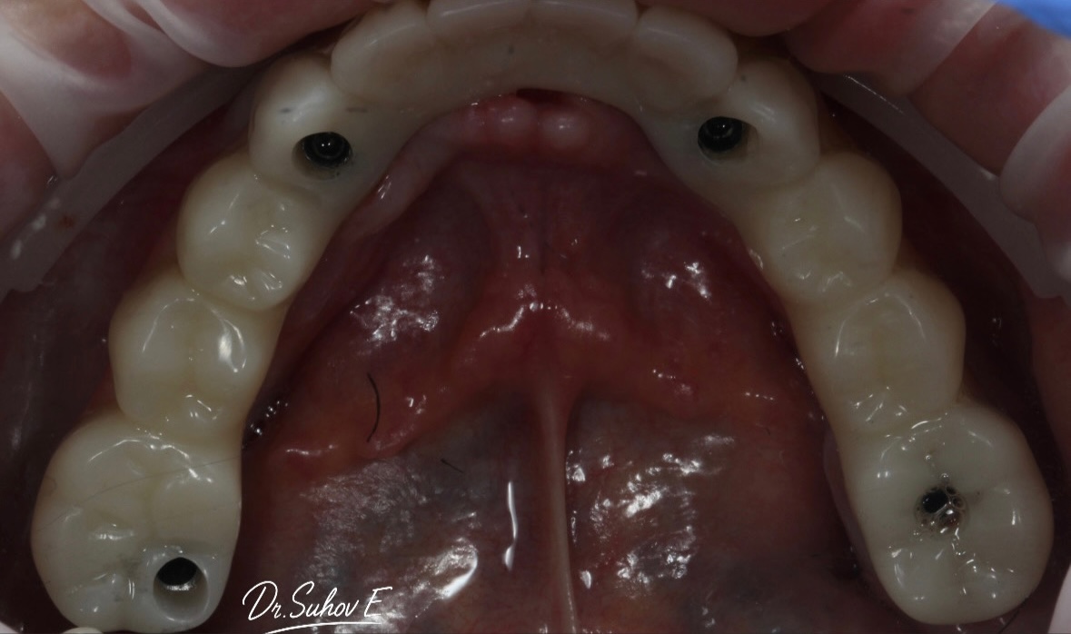 После лечения