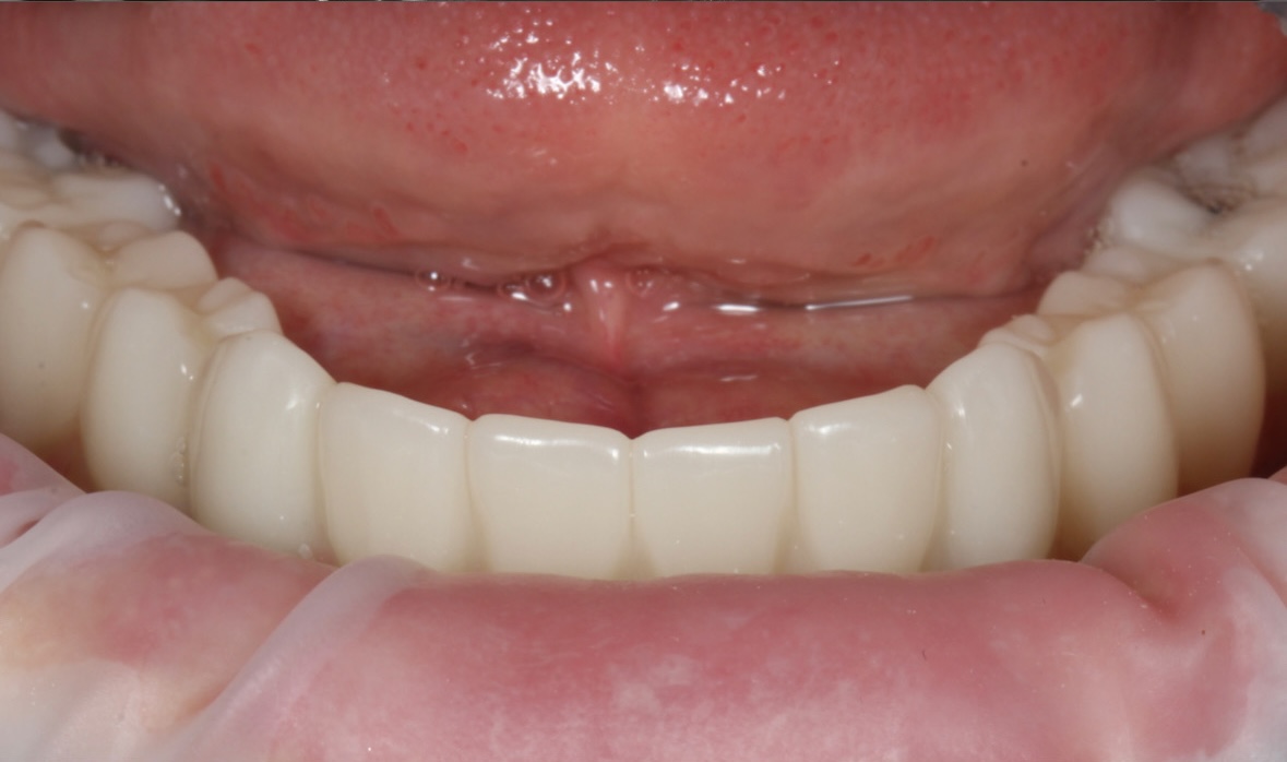 После лечения