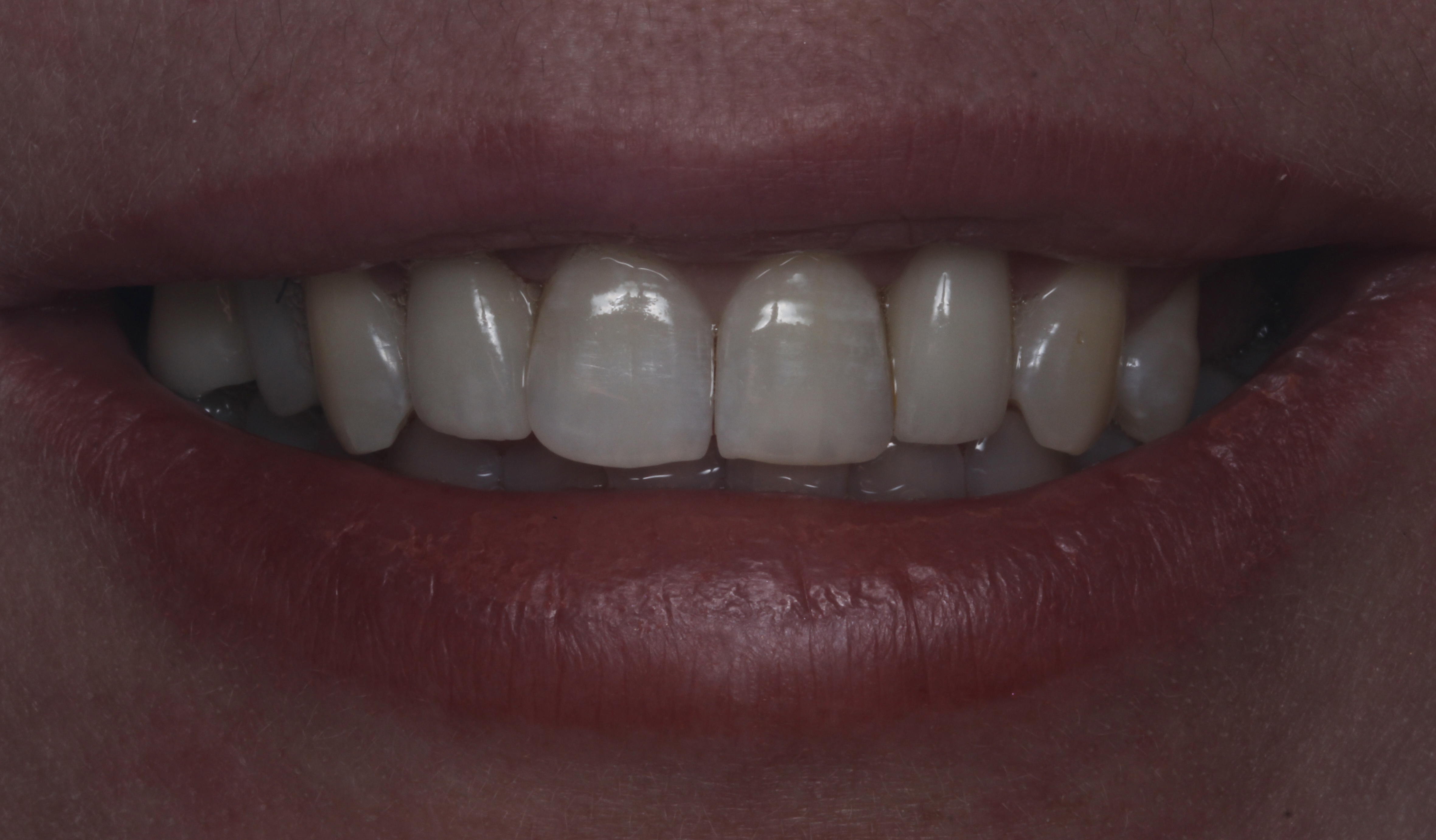 После лечения