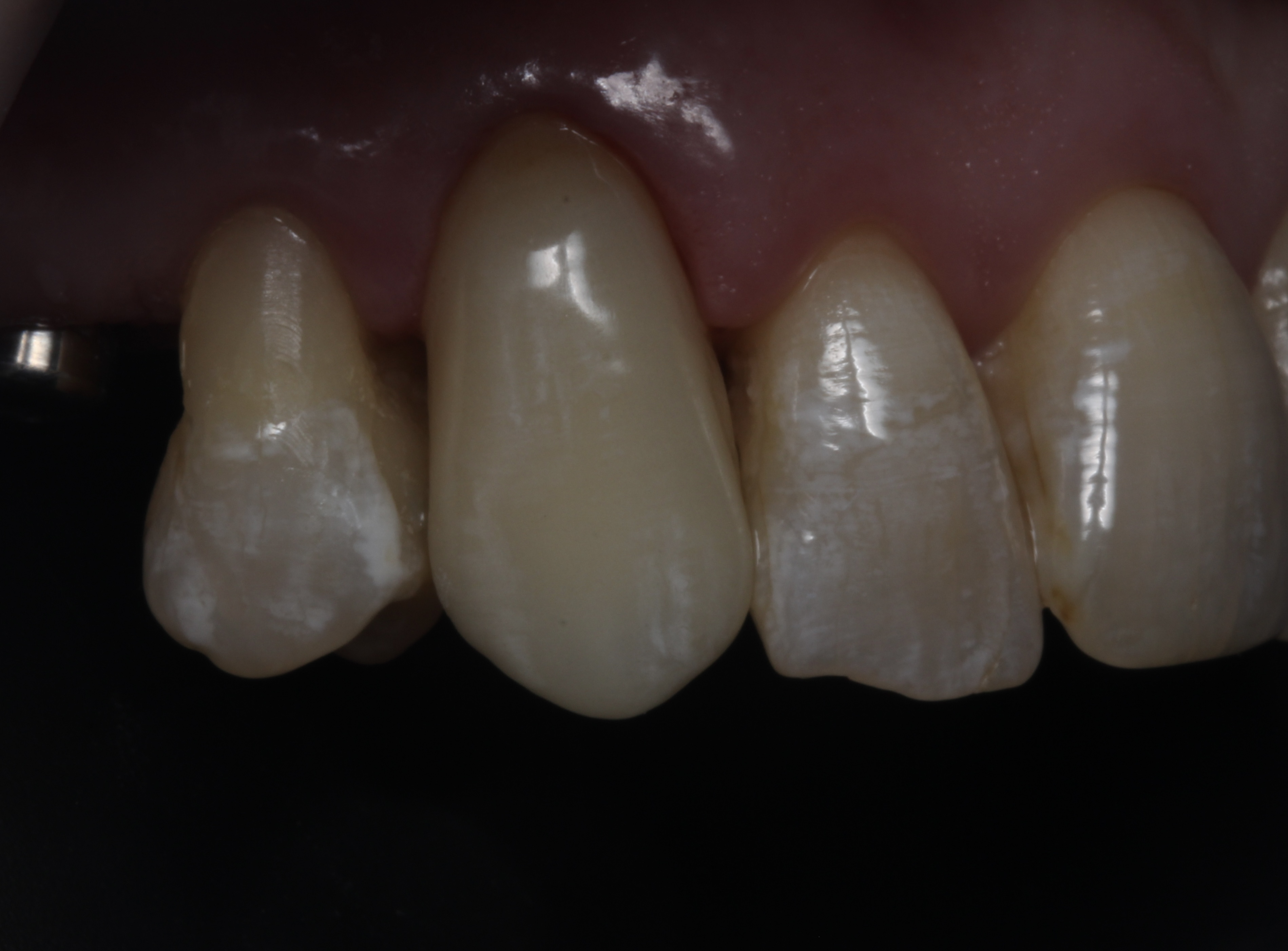 После лечения